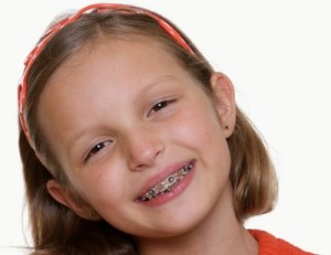 Làm gì khi hàm răng của trẻ bị hô 