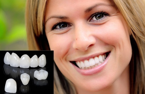 Bọc răng sứ có bị biến chứng hay không?