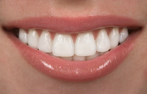 Tư vấn bảo vệ những chiếc răng sau khi điều trị tủy